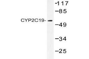 Western blot analysis of CYP2C19 antibody in extracts from 293 cells. (CYP2C19 antibody)