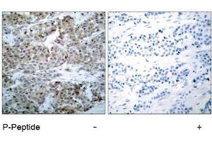 Image no. 1 for anti-BCL2-Associated Agonist of Cell Death (BAD) (pSer112), (pSer75) antibody (ABIN196735) (BAD antibody  (pSer75, pSer112))