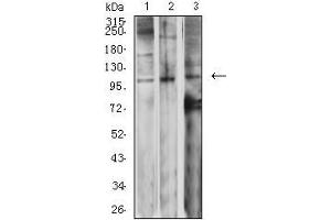 Western blot analysis using GRM2 mouse mAb against SK-N-SH (1), Jurkat (2), and SW620 (3) cell lysate. (GRM2 antibody  (AA 414-558))
