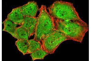 Immunofluorescence analysis of Hela cells using NS1 mouse mAb (green). (Parvovirus B19 NS1 (AA 1-216) antibody)