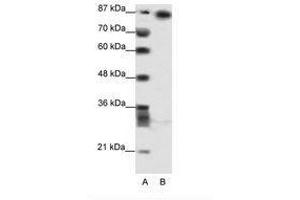 Image no. 1 for anti-Myoneurin (MYNN) (AA 281-330) antibody (ABIN202812) (Myoneurin antibody  (AA 281-330))