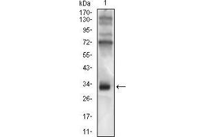 Western blot analysis using CD74 mouse mAb against Raji cell lysate.