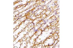 Immunohistochemistry (Paraffin-embedded Sections) (IHC (p)) image for anti-Linker For Activation of T Cells Family, Member 2 (LAT2) antibody (ABIN7074503)