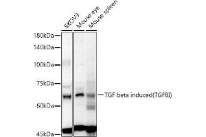 Western blot analysis of extracts of various cell lines, using TGF beta induced (TGFBI) antibody (ABIN6128864, ABIN6149078, ABIN6149080 and ABIN6215116) at 1:1000 dilution. (TGFBI antibody  (AA 481-683))