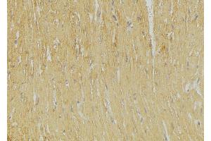 ABIN6269251 at 1/100 staining Mouse muscle tissue by IHC-P. (GRIA2 antibody  (C-Term))