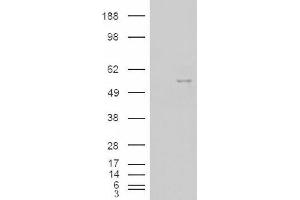 Image no. 2 for anti-Neuro-Oncological Ventral Antigen 1 (NOVA1) (Internal Region) antibody (ABIN375110)