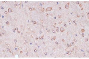 Immunohistochemistry of paraffin-embedded Mouse brain using CARTPT Polyclonal Antibody at dilution of 1:100 (40x lens). (CARTPT antibody)