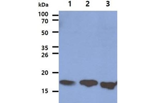 LSM5 anticorps