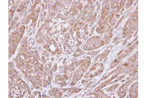 IHC-P Image Immunohistochemical analysis of paraffin-embedded A549 xenograft , using HSD3B2, antibody at 1:100 dilution. (HSD3B2 antibody)
