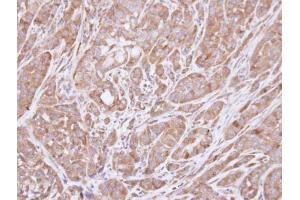 IHC-P Image Immunohistochemical analysis of paraffin-embedded A549 xenograft , using HSD3B2, antibody at 1:100 dilution.
