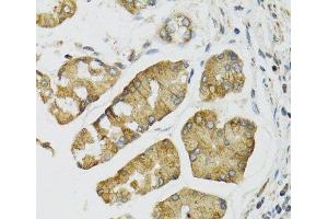 Immunohistochemistry of paraffin-embedded Human esophagus using PI3 Polyclonal Antibody at dilution of 1:100 (40x lens). (PI3 antibody)