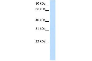 MLF2 antibody used at 5 ug/ml to detect target protein. (MLF2 antibody  (Middle Region))