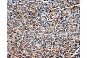 Immunohistochemical staining of paraffin-embedded liver tissue using anti-RC201933 mouse monoclonal antibody. (PIM2 antibody)