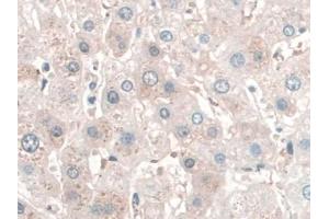 DAB staining on IHC-P; Samples: Human Liver Tissue (SPAG1 antibody  (AA 1-365))