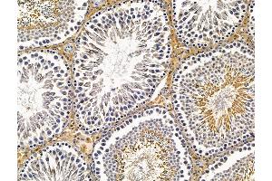 ABIN7096201 and ABIN7100263 at 1/100 staining rat testis tissue by IHC-P. (KANK4 antibody)