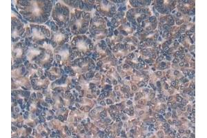 Immunohistochemistry (IHC) image for anti-Glutathione Reductase (GSR) (AA 240-500) antibody (ABIN7442147)