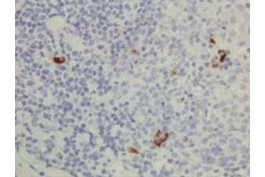 Immunohistochemical staining (Formalin-fixed paraffin-embedded sections) of human lymphoid tissue with Human IgG3 monoclonal antibody, clone RM119 (Biotin) . (Rabbit anti-Human IgG3 Antibody (Biotin))