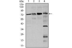 Western blot analysis using FOXO1 mouse mAb against Hela (1), HEK293 (2), MCF-7(3), and C6 (4) cell lysate. (FOXO1 antibody)