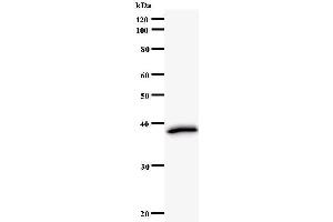 Western Blotting (WB) image for anti-Protein Arginine Methyltransferase 2 (PRMT2) antibody (ABIN931133)