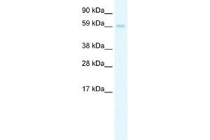 WB Suggested Anti-AIRE Antibody Titration:  0. (AIRE antibody  (N-Term))