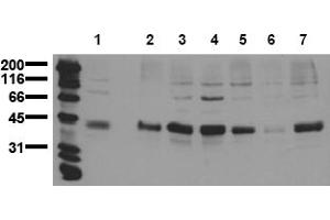 Western Blotting (WB) image for anti-Aurora Kinase A (AURKA) (C-Term) antibody (ABIN492609) (Aurora A antibody  (C-Term))