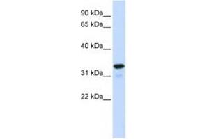 Image no. 1 for anti-Nuclear Factor of kappa Light Polypeptide Gene Enhancer in B-Cells Inhibitor, alpha (NFKBIA) (C-Term) antibody (ABIN6744364)