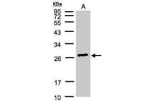 WB Image Sample(30 μg of whole cell lysate) A:Hep G2, 12% SDS PAGE antibody diluted at 1:3000 (GSTa2 antibody)