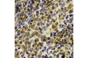 Immunohistochemical analysis of BTK staining in human spleen formalin fixed paraffin embedded tissue section. (BTK antibody)
