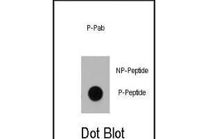 Dot blot analysis of anti-Dnmt1 Phospho-specific Pab (ABIN389901 and ABIN2839739) on nitrocellulose membrane. (DNMT1 antibody  (pSer714))