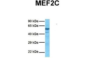 Host:  Rabbit  Target Name:  MEF2C  Sample Tissue:  Human Fetal Brain  Antibody Dilution:  1. (MEF2C antibody  (N-Term))