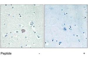 Immunohistochemistry analysis of paraffin-embedded human brain tissue using ADORA2A polyclonal antibody .