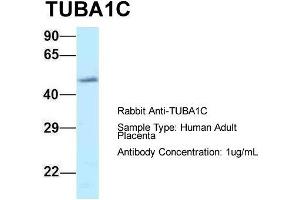 Host: Rabbit  Target Name: TUBA1C  Sample Tissue: Human Adult Placenta  Antibody Dilution: 1. (TUBA1C antibody  (C-Term))
