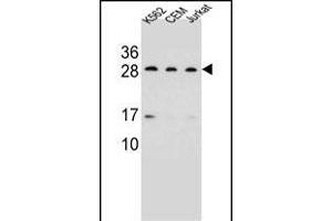 CD79A Antibody (C-term) (ABIN656983 and ABIN2846166) western blot analysis in K562,CEM,Jurkat cell line lysates (35 μg/lane).