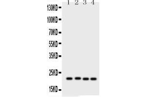 Anti- Picoband antibody, PB, Western blottingAll lanes: Anti SOCS2  at 0. (SOCS2 antibody  (AA 96-198))