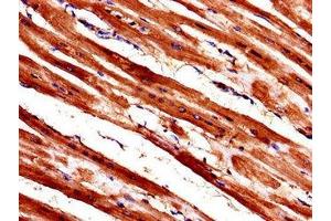 Immunohistochemistry of paraffin-embedded human heart tissue using ABIN7175846 at dilution of 1:100 (WISP1 antibody  (AA 130-251))