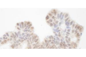 Immunohistochemistry (IHC) image for anti-SIN3 homolog A, transcription regulator (SIN3A) (AA 1-50) antibody (ABIN7448796) (SIN3A antibody  (AA 1-50))