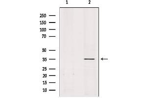 Western blot analysis of extracts from rat brain, using OR51A1P Antibody.
