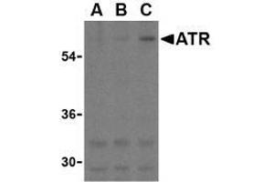 Western blot analysis of ATR in K562 cell lysates with this product atR antibody at (A) 0.