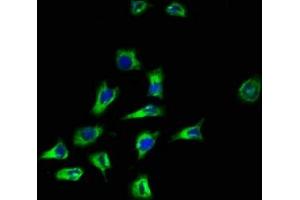 Immunofluorescence staining of A549 cells with ABIN7169583 at 1:100, counter-stained with DAPI. (CD164 antibody  (AA 24-162))