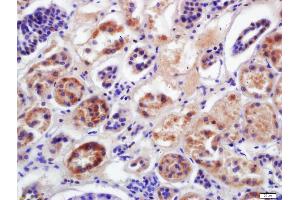 Formalin-fixed and paraffin embedded human kidney labeled with Anti-CYP2D6 Polyclonal Antibody, Unconjugated (ABIN682558) at 1:200 followed by conjugation to the secondary antibody and DAB staining (CYP2D6 antibody  (AA 101-210))