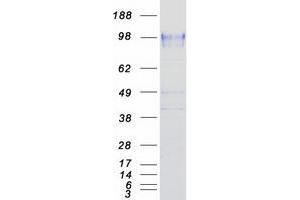 Validation with Western Blot (P-Selectin Protein (Myc-DYKDDDDK Tag))