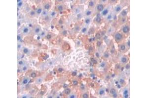 Used in DAB staining on fromalin fixed paraffin- embedded Kidney tissue (Cortactin antibody  (AA 1-509))