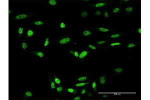 Immunofluorescence of purified MaxPab antibody to ING4 on HeLa cell. (ING4 antibody  (AA 1-249))