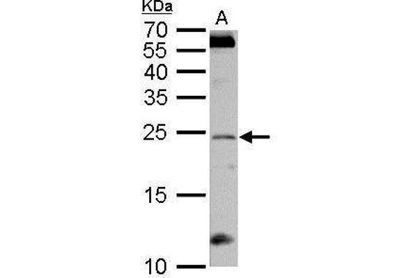 RGS4 antibody