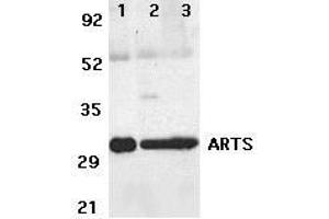 Western blot analysis of ARTS expression in human lung (lane 1),spleen (lane 2), and kidney (lane 3) tissue lysates with ARTS antibody at 2μg /ml. (Septin 4 antibody  (N-Term))