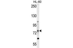 ABCD1 Antibody (Center) western blot analysis in HL-60 cell line lysates (35 µg/lane). (ABCD1 antibody  (Middle Region))