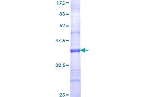 ITGA8 Protein (AA 836-935) (GST tag)