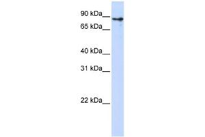 WB Suggested Anti-KLHL1 Antibody Titration:  0.