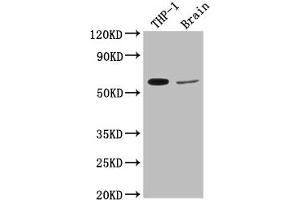 Western Blot Positive WB detected in: THP-1 whole cell lysate, Rat brain tissue All lanes: COL9A2 antibody at 1:2000 Secondary Goat polyclonal to rabbit IgG at 1/50000 dilution Predicted band size: 66 kDa Observed band size: 66 kDa (Collagen Type IX alpha 2 (COL9A2) (AA 594-611) antibody)