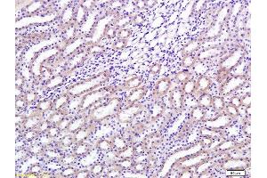 Formalin-fixed and paraffin embedded rat renal tissue labeled with Anti-TGF-beta-1 Polyclonal Antibody, Unconjugated (ABIN724685) 1:200 followed by conjugation to the secondary antibody and DAB staining (TGFB1 antibody  (AA 351-390))